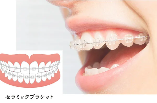 マルチブラケット装置
